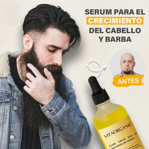 SERUM PARA CRECIMIENTO DE CABELLO